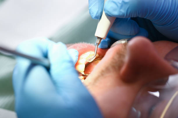 Best Emergency Denture Repair in New Ulm, MN