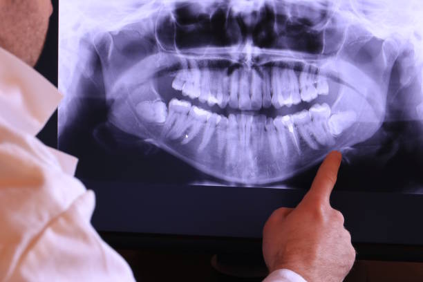 Best Emergency Dental Care for Broken or Chipped Teeth in New Ulm, MN